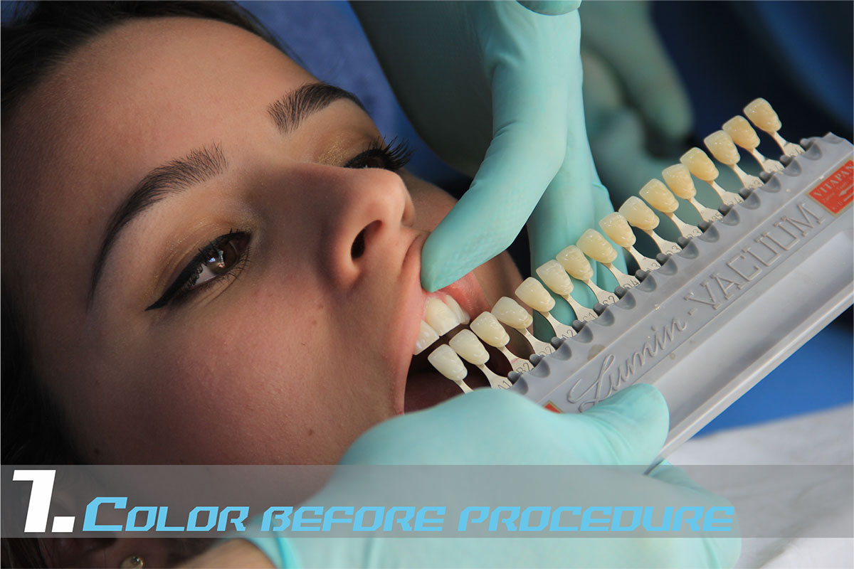 Medellin Teeth Whitening Medellin Teeth Whitening