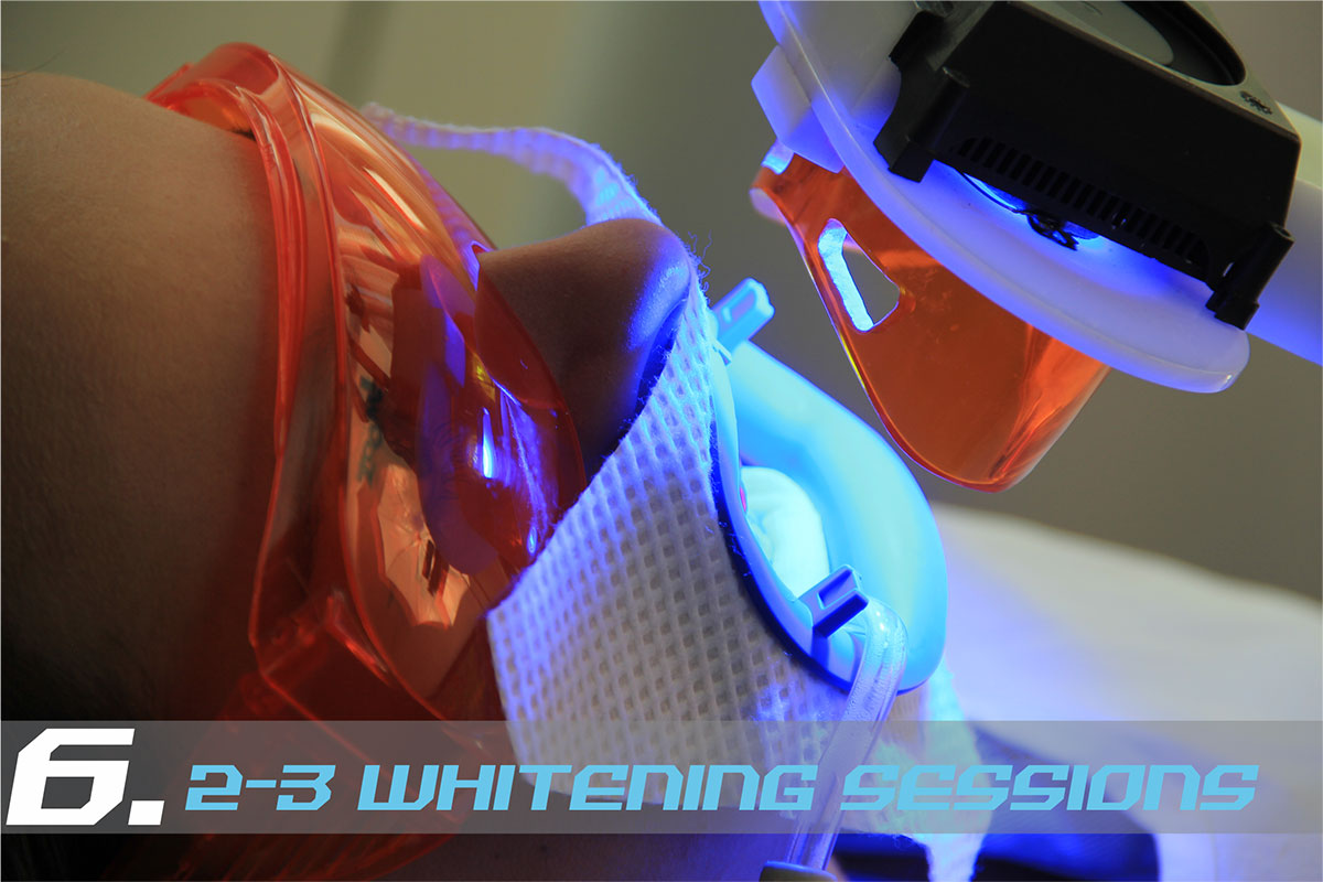 Medellin Teeth Whitening Medellin Teeth Whitening